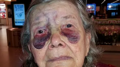O bătrână a fost bătută cu bestialitate de fiică şi ginere! Imagini şocante şi povestea sfâşietoare a femeii care vrea să scape de acasă