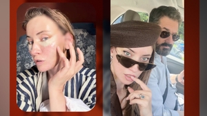 Iulia Albu și-a făcut lifting facial! Cum arată vedeta după intervenție: ”Nu îmi căzuse fața, dar mi-am dorit-o”
