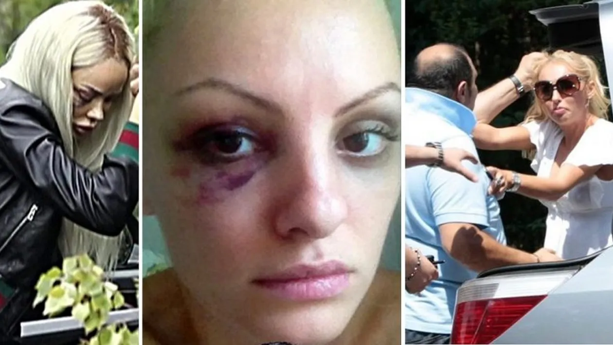 Bianca Drăgușanu nu e singura! TOP 20 - Vedete din România rupte cu bătaia de iubiții lor