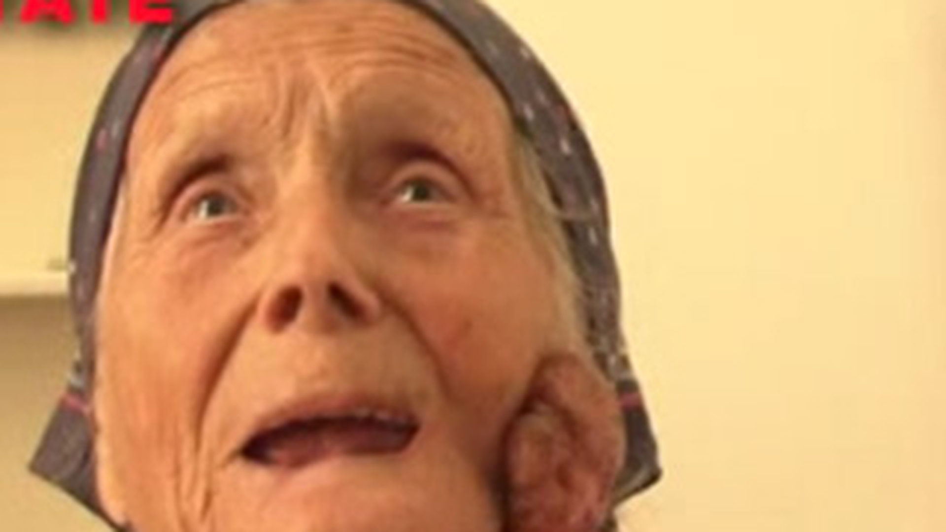 O batrana de 91 de ani, operata a doua oara de cancer: "Mi-a aparut o buba pe fata care ma durea si a inceput sa sangereze"