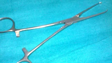 Un forceps chirurgical, uitat sase luni in abdomen, a iesit prin buricul unei femei din Franta