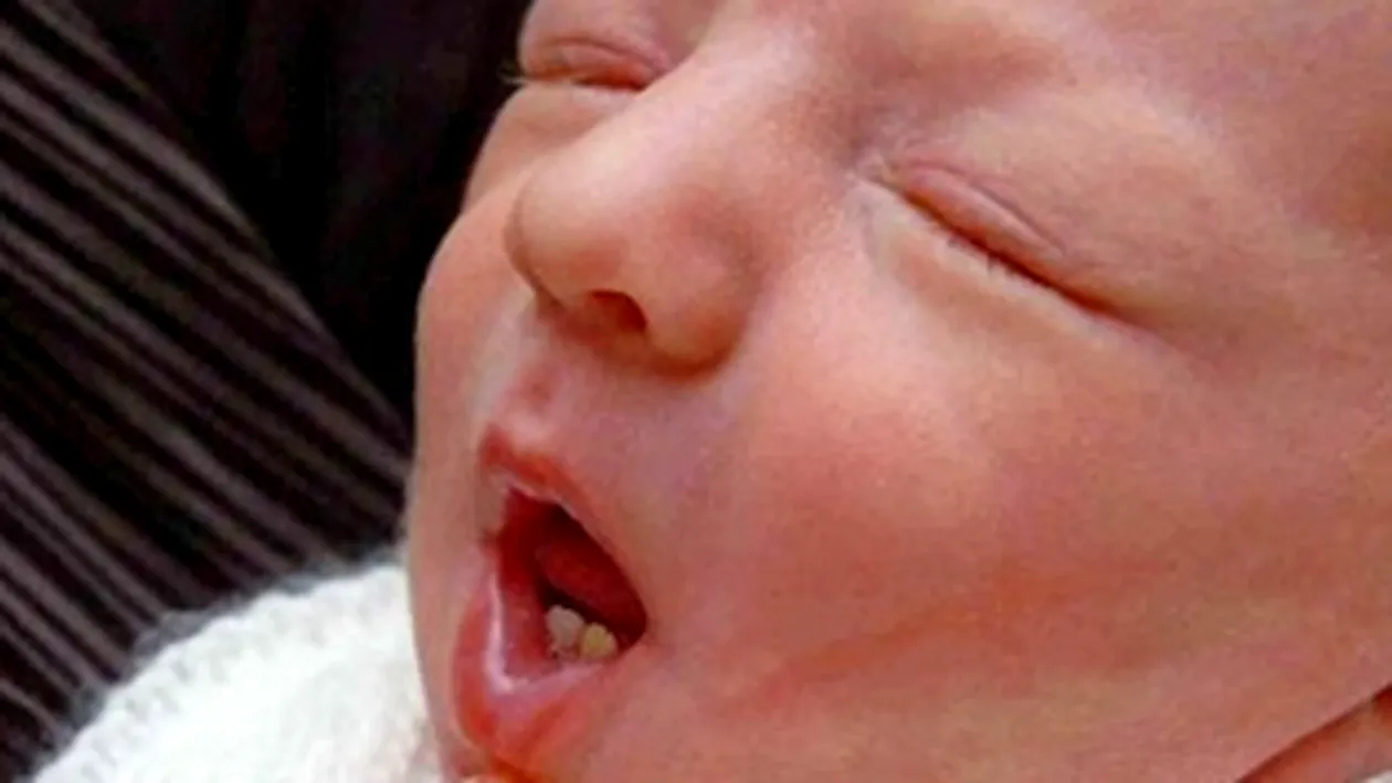 Un copil s-a nascut cu doi dinti!