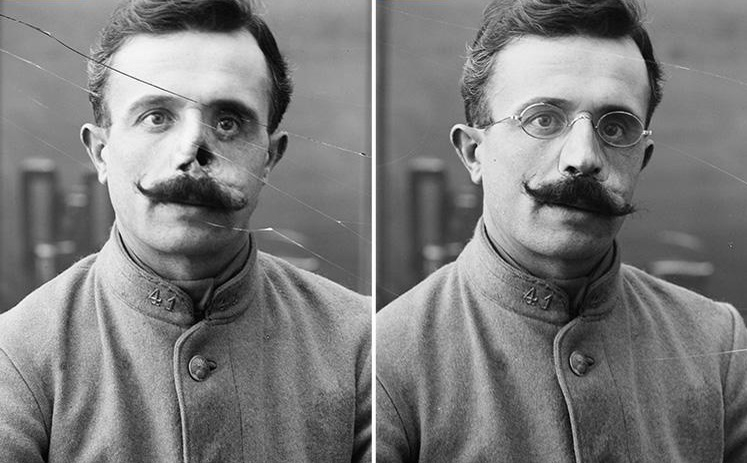 Imagini rare cu soldaţii din Primul Război Mondial! Transformarea incredibilă prin care treceau dacă erau desfiguraţi pe câmpul de luptă