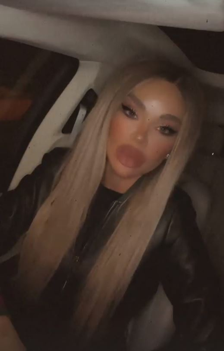 Bianca Drăgușanu a publicat mai multe imagini după ce a fost snopită de Alex Bodi: “Pentru pozele în care apar bătută, am depus o plângere penală” | FOTO