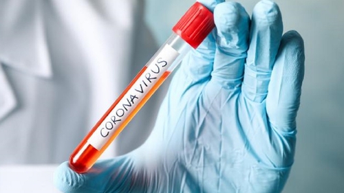 Coronavirus. Harta lumii, din ce în ce mai roșie! Pe ce loc se situează România, în topul țărilor afectate de Covid-19