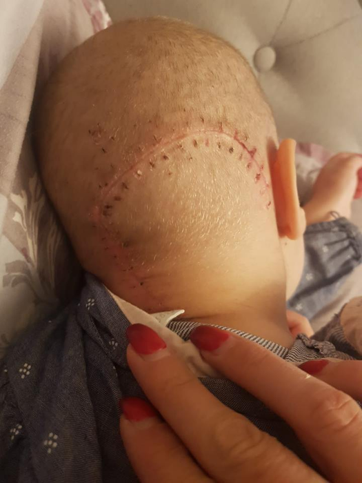 Victor Slav, apel emoționant pentru salvarea Anastasiei, o fetiță de 3 ani care se luptă cu cancerul! “I-a acoperit toată emisfera stângă a creierului”