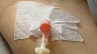 Un tanar din Sibiu a fost muscat de o capusa si acum este suspect de encefalita!