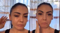 Ce truc folosește Andreea Mantea ca să își dezumfle fața. Așa ceva... „Doare un pic!”