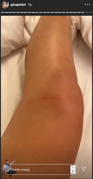 Primele imagini cu Gina Pistol după căzătură. Cum se simte graviduța