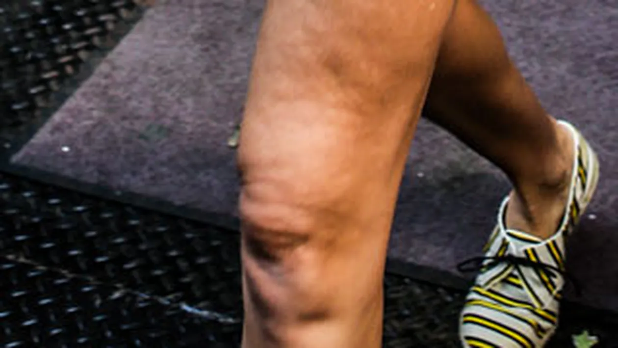 Nu-i chiar perfecta, pana la urma! Una dintre cele mai sexy actrite are picioarele invadate de celulita