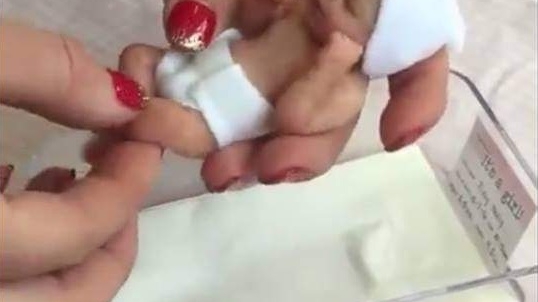 Imagini care au emoționat o lume întreagă! Cel mai mic bebeluș din lume
