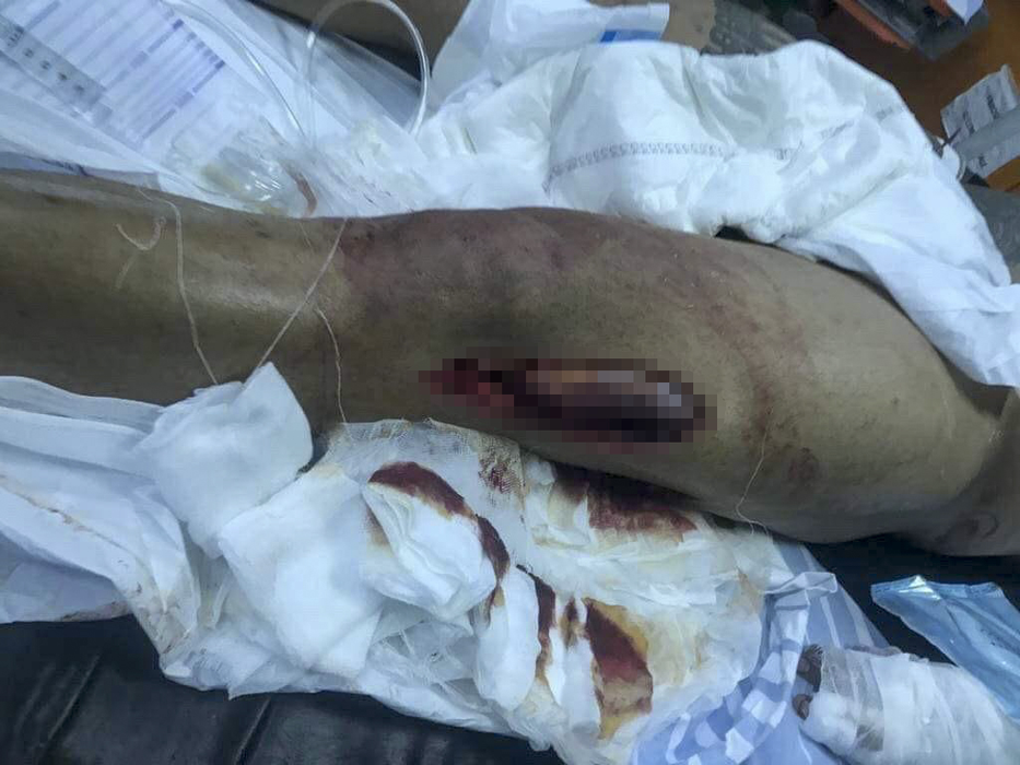 Bebino a ajuns pe masa de operație, cu răni grave