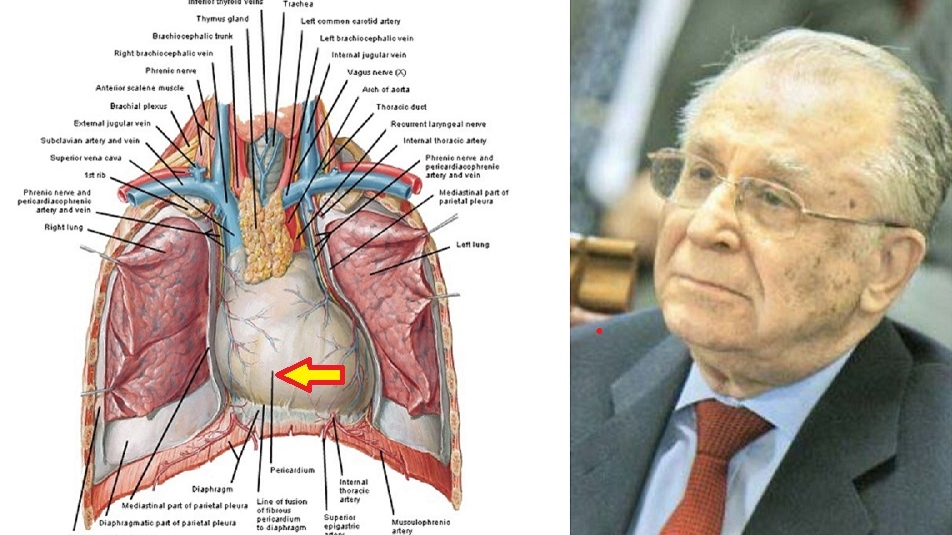 Ce este, de fapt, pericardita hemoragică, boala cu care a fost diagnosticat Ion Iliescu