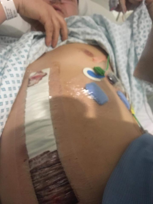Scene de groază în Londra! Un român a fost înjunghiat în cap și lângă inimă de un grup imens de copii! A scăpat ca prin urechile acului. Atenție, imagini șocante!
