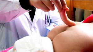 Copilul ei s-a nascut cu o coada de 13 centimetri, iar medicii refuza sa il opereze! Drama unei mame din China a induiosat planeta