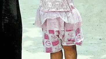 O boala misterioasa ii face viata un calvar unei copile din China! Fetita cu picioare de urias