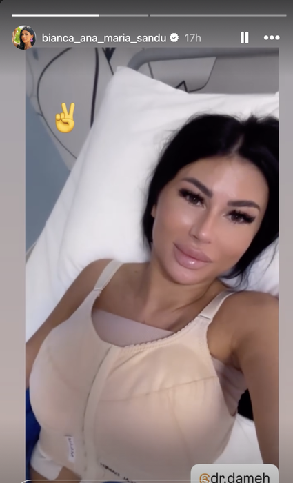 Bianca de la Insula iubirii s-a ”tunat”. Cum arată după ultima operație estetică