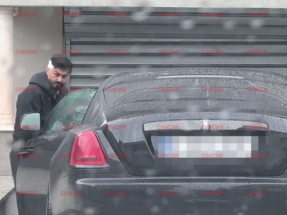 Avem primele imagini cu Jador, după ce și-a pus implant de păr