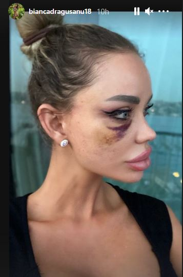 Alex Bodi a recunoscut! De ce a bătut-o, de fapt, pe fosta lui soţie, Bianca Drăguşanu: „Să dau eu într-o femeie trebuie să existe o sumedenie de provocări”