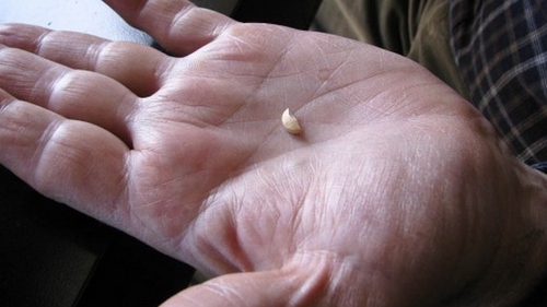 Este incredibil ce a putut sa pateasca un barbat de 70 de ani din Romania care a luat o pastila pentru potenta