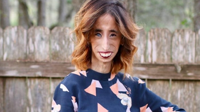 A fost catalogată “cea mai urâtă femeie din lume”, iar acum... Cum arată, în prezent, Lizzie Velasquez