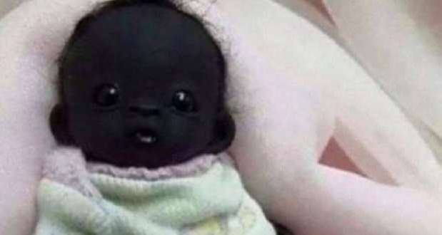 Edam a fost considerat încă de la naştere drept cel mai negru bebeluş din lume, din cauza pigmentului neobişnuit pe care îl are pielea lui