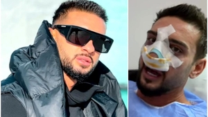 Motivul real pentru care Dorian Popa nu-și operează nasul. Care este cea mai mare frică a artistului