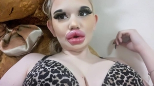 Femeia cu cele mai mari buze din lume s-a operat din nou! Cum arată acum Andrea Ivanova. „Nu există limite”