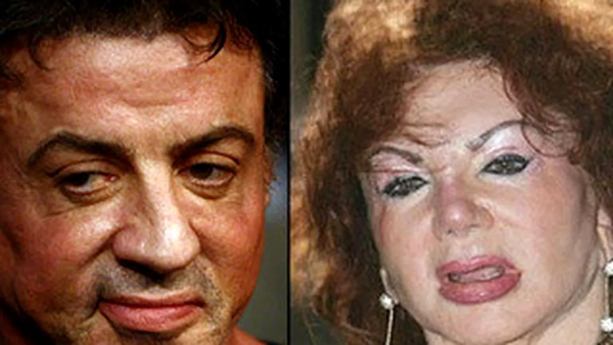 Sylvester Stallone si mama acestuia, clienti fideli ai cabinetelor de remodelare plastica!