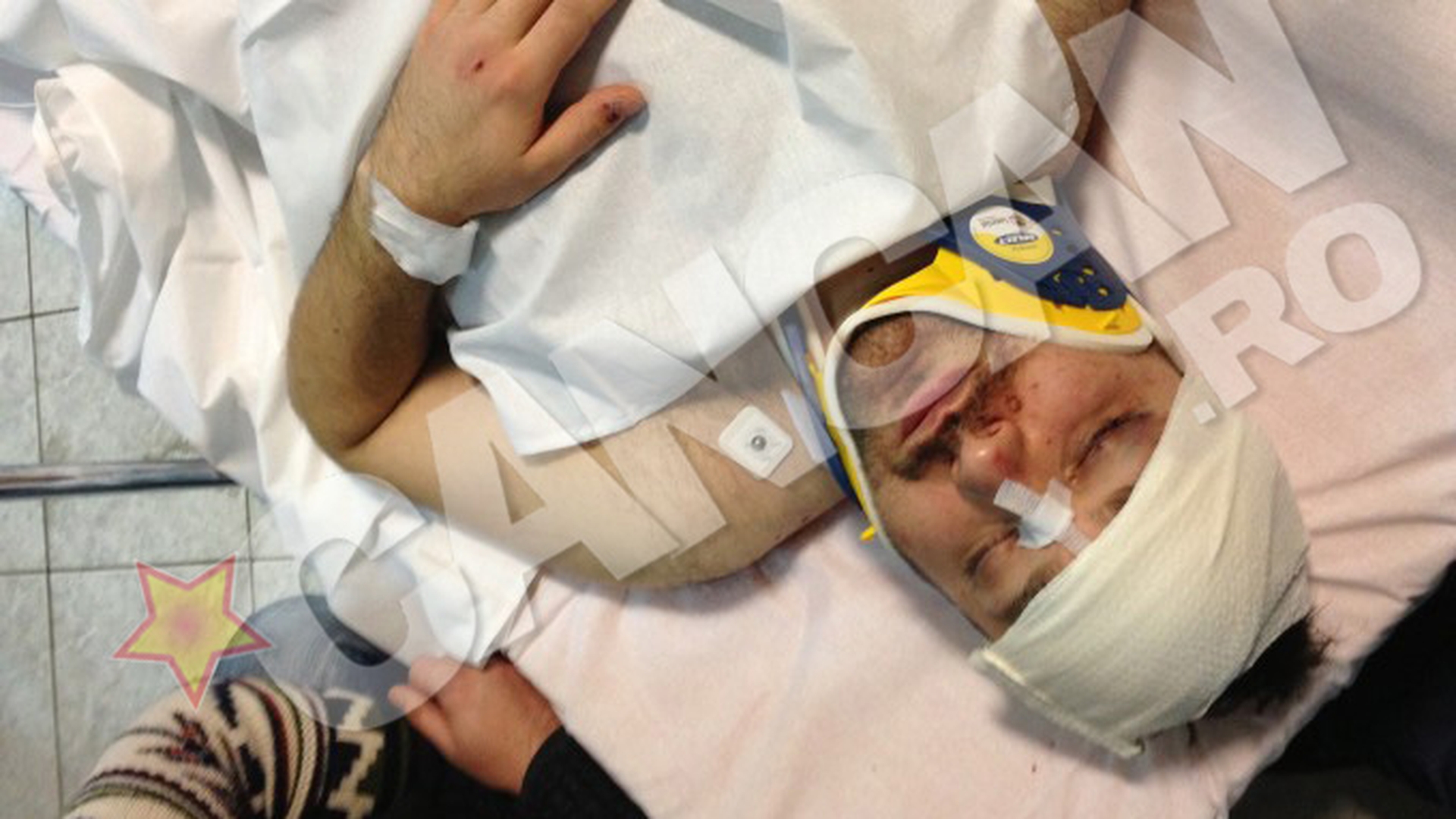 Batut mar in plina strada. Atacat de trei malaci, Andrei Tirdea a ajuns la spital aproape inconstient. Are capul spart in 3 locuri