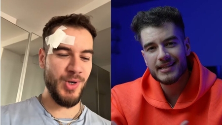 Ce s-a întâmplat cu Theo Zeciu. Fostul concurent de la Power Couple a apărut lovit la cap