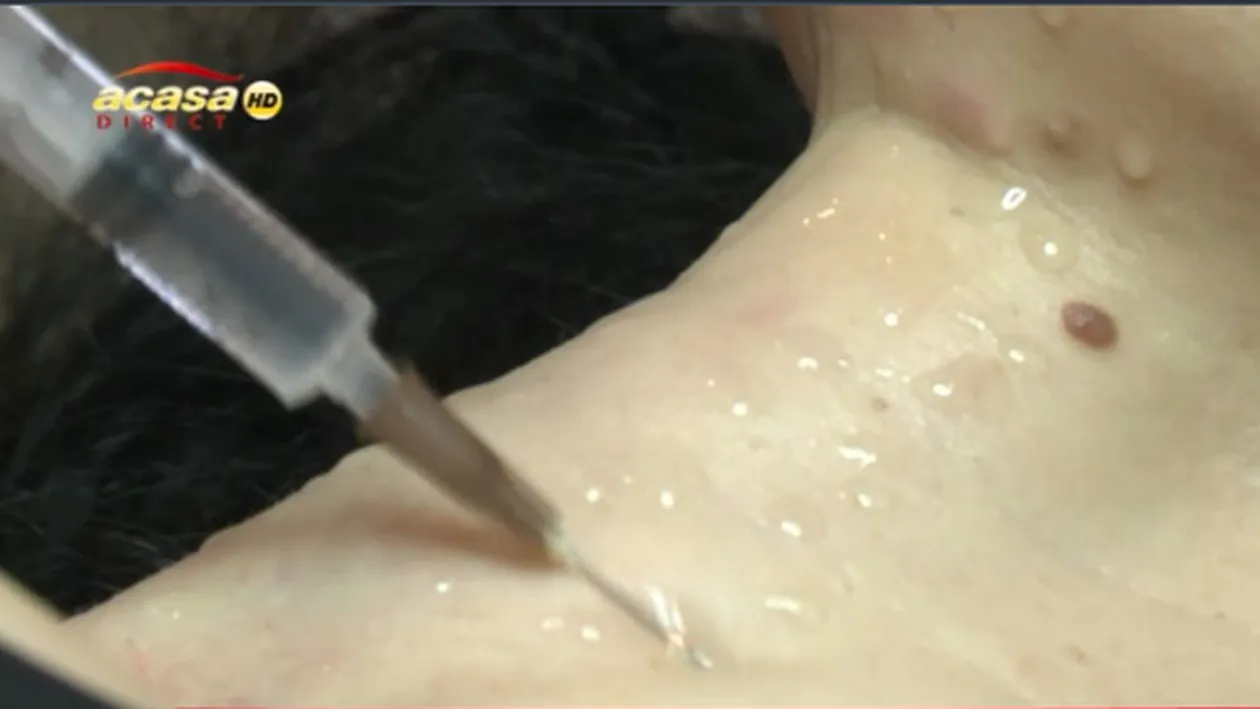 Ce face fosta iubita iubita a barbatului care le-a avut in patul sau pe Cristina Rus si Oana Zavoranu! Cat sufera pentru frumusete