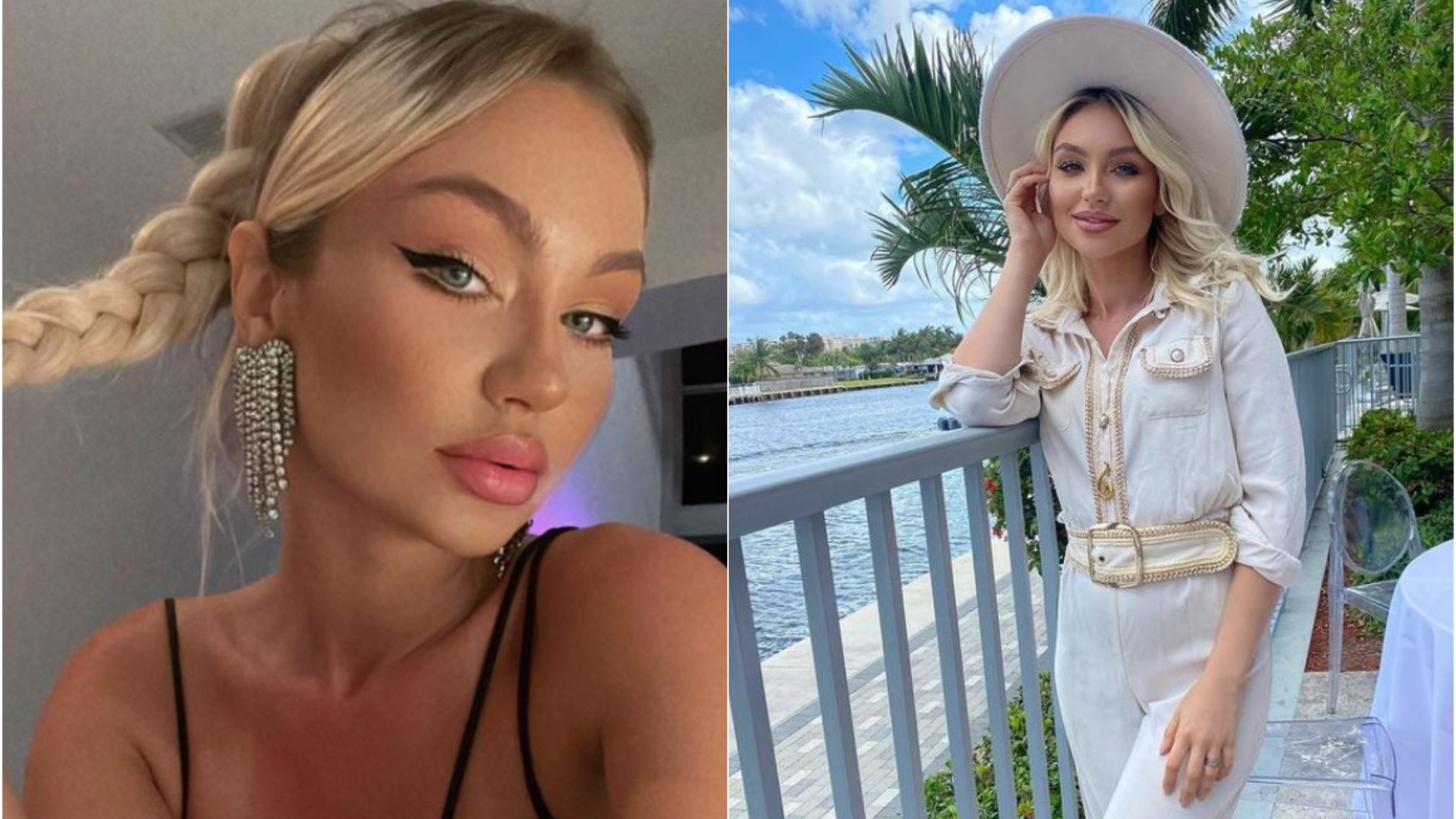 Bianca Alexandra, fosta concurentă de la „Bravo, ai stil!”, s-a accidentat grav în vacanță. Tânăra a apărut cu fața bandajată: ”Ne țin sechestrați în hotel”