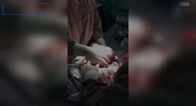 Imagini emoționante în sala de operații: un băiețel s-a născut în timp ce era încă în sacul amniotic. Cazul este foarte rar: 1 la 80.000 de nașteri | FOTO & VIDEO