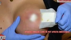 Drama Mădălinei-Beyonce de România, după implantul cu silicon. ”Mi-a căzut mamelonul, iar sânul mi se macină pe zi ce trece”