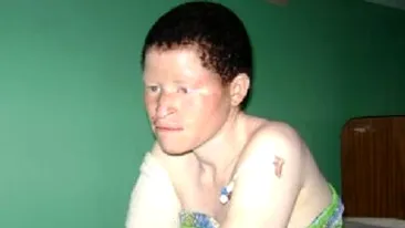 Au mutilat-o pentru bani