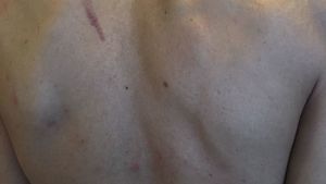 Români terorizaţi în Irlanda. "Am fost omorâţi în bătaie!" Mesaj disperat pentru autorităţi