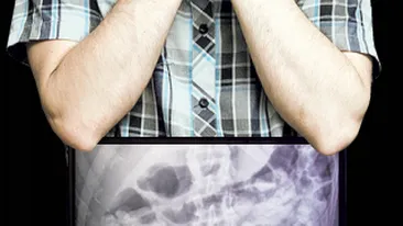 Avea stomacul burdusit cu droguri