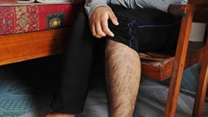 Ai sa ramai socat! Unei fete de 16 ani i-a crescut barba, in urma unui tratament pentru o boala rara! NU ai sa crezi ca este femeie!