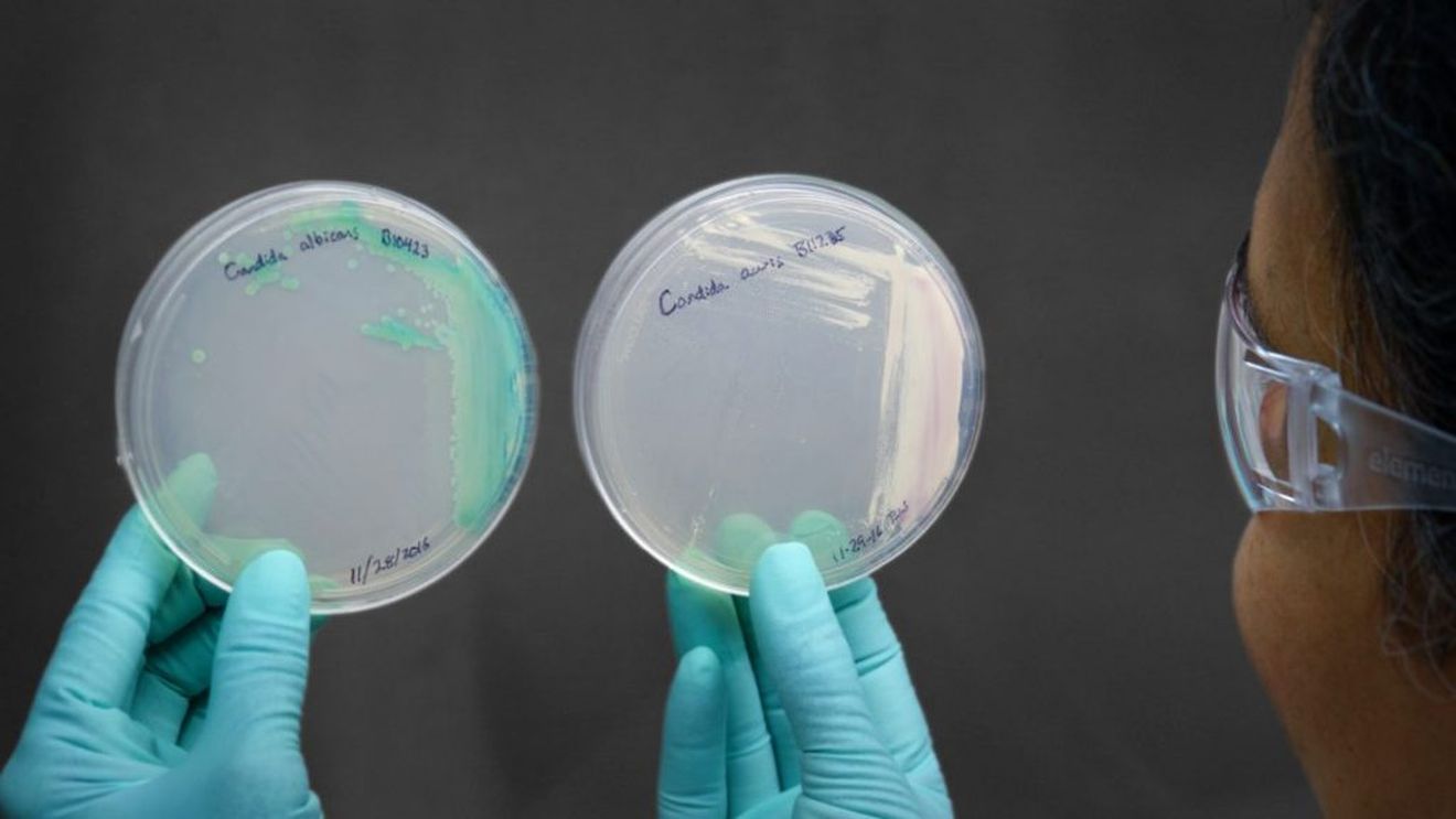 Groaza pune stăpânire pe omenire! Boala care lovește ca ciuma și nimeni n-are o soluție!