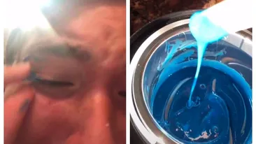 Îngrozitor! Ce a pățit o tânără, după ce a încercat să se penseze cu ceară. A trecut prin dureri cumplite!