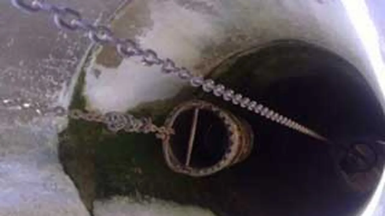 Tanar in stare grava la spital dupa ce a cazut de la zece metri in fantana pe care o sapa