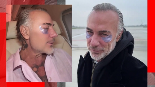Imagini îngrijorătoare cu milionarul Gianluca Vacchi! Fanii se tem că ascunde o boală gravă