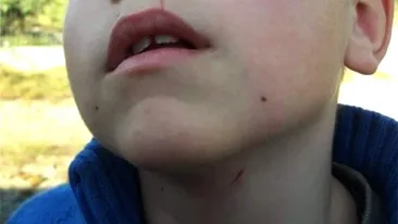 După ce a fost acuzat că a strâns un elev de gât, învățătorul din Botoșani și-a dat demisia