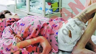 Fratele fetitei de 15 ani si 13 kilograme: "Gabriela a fost alimentata tot timpul"