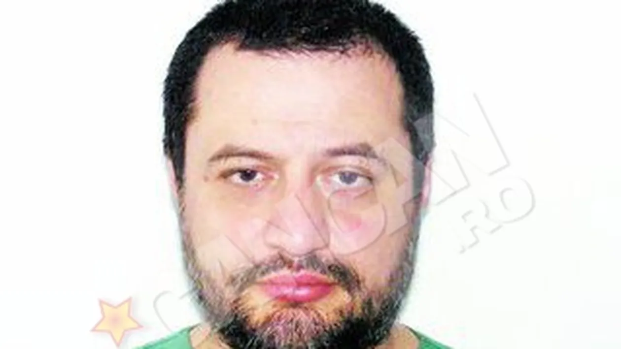 Paralizia fetei, corectata chirurgical