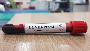 Coronavirus în România! Au fost raportate încă șase decese. Bilanțul negru ajunge la 1.276