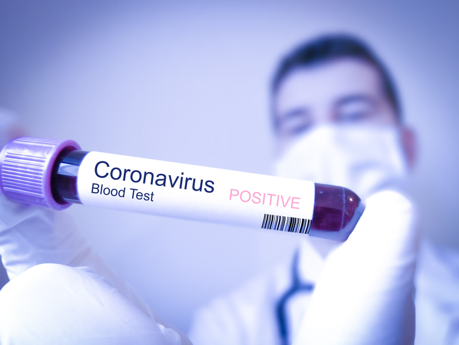 Coronavirusul face în continuare victime