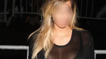 A inceput sa CHELEASCA dupa sarcina! Vedeta cunoscuta in toata lumea care a patit asa ceva! Arata INGROZITOR