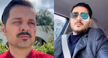 Liviu Vârciu, de urgență la spital după ce a suferit un accident: ”M-a ferit Dumnezeu, că puteam să fiu...”
